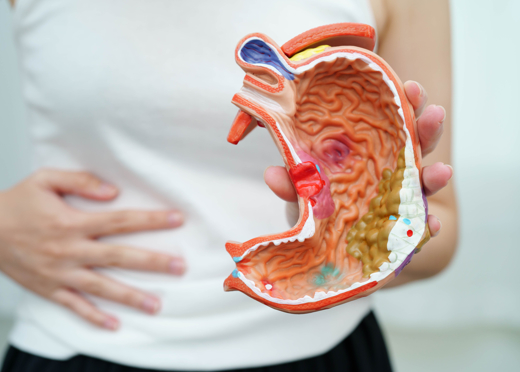 Mide Yanması Neden Olur? Mide Yanmasına Ne İyi Gelir?