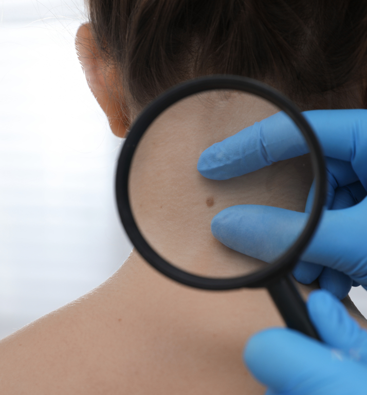 Uzm. Dr. Tuğçe Özkapu: Cilt Check-Up’ınızı Ertelemeyin