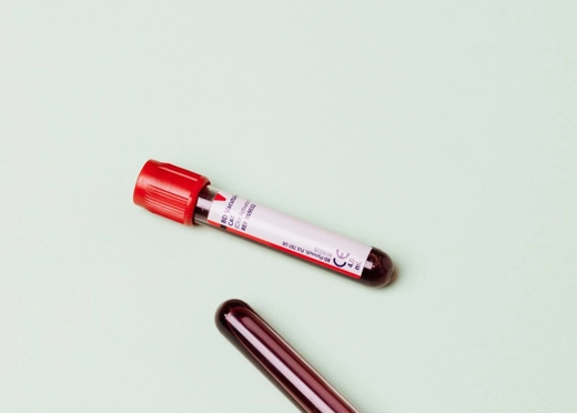 Troponin Nedir? Türleri Nelerdir?